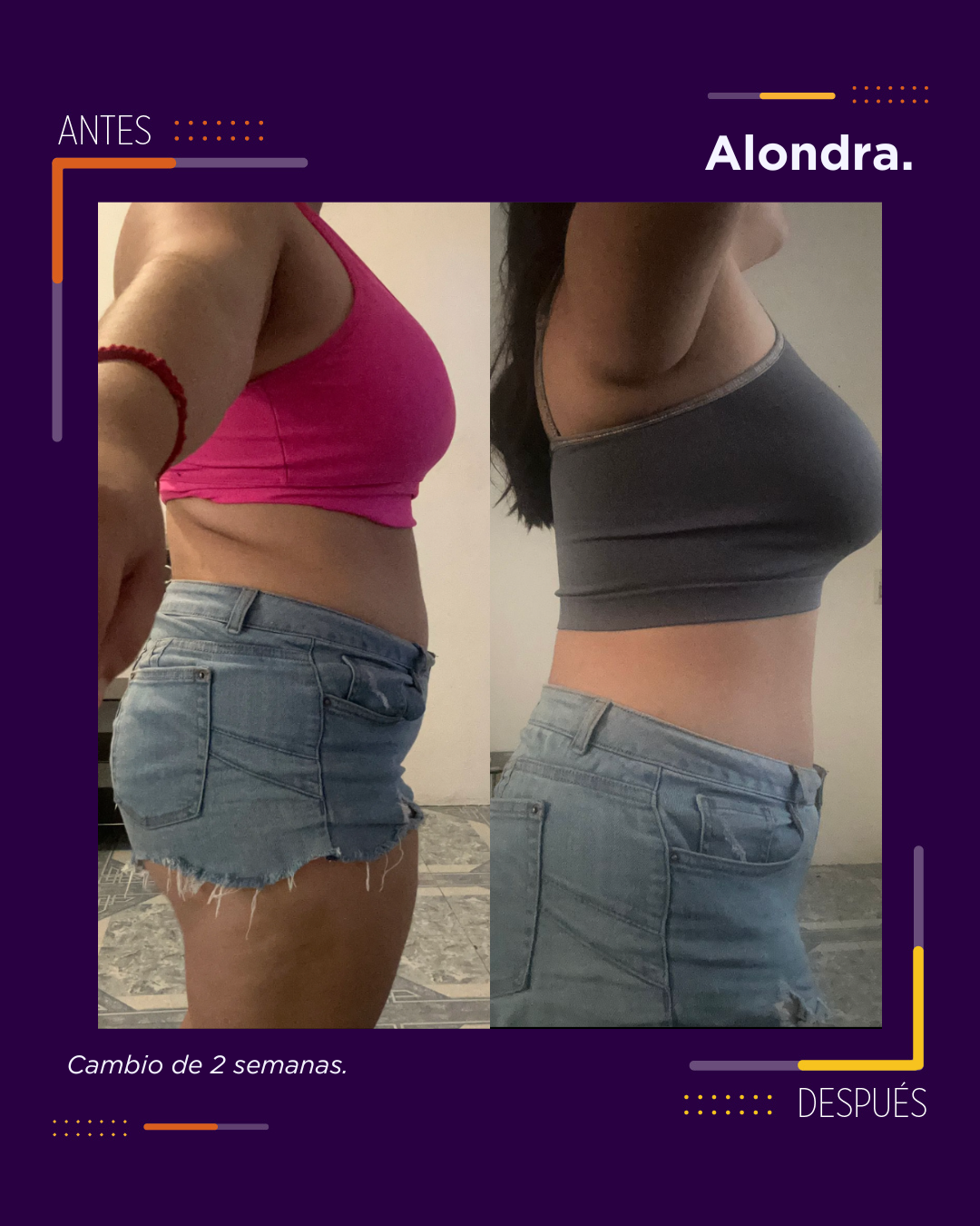 Caso 12