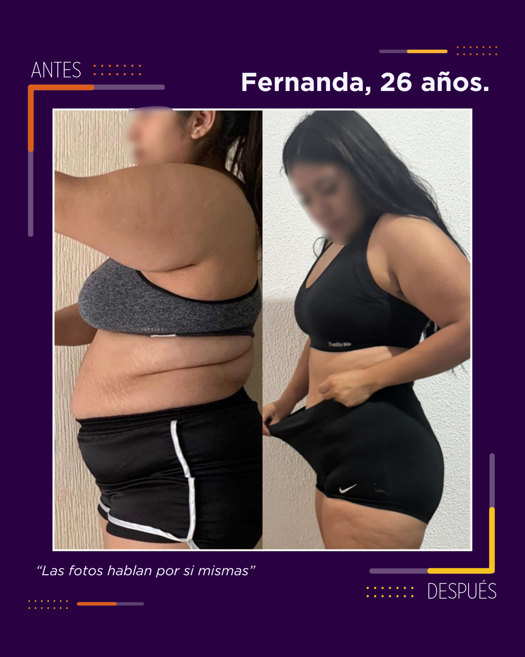 Caso 17