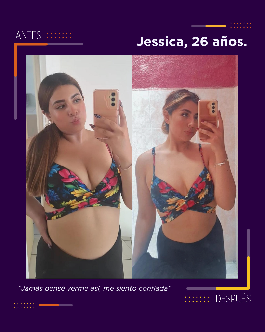 Caso 32